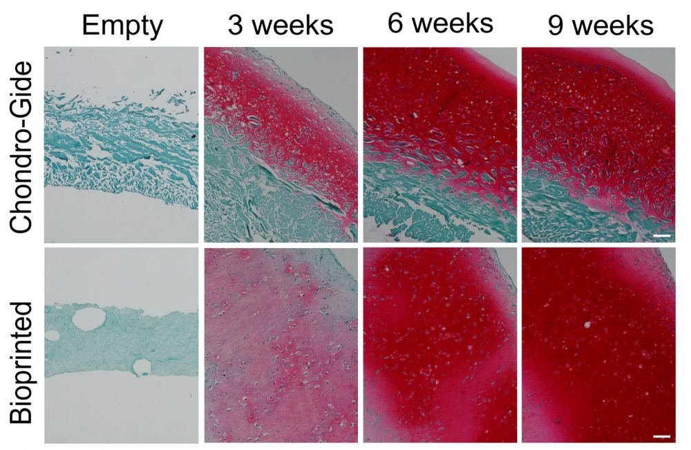 Timeline evolution of bioprinted nasal cartilage grafts